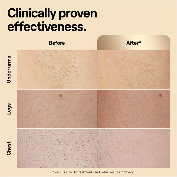 Braun Silk-expert Pro 5 háreyðingartæki