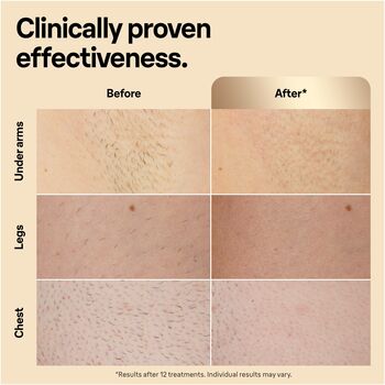 Braun Silk-expert Pro 5 háreyðingartæki