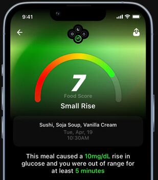 Ultrahuman M1 blóðsykursmælir