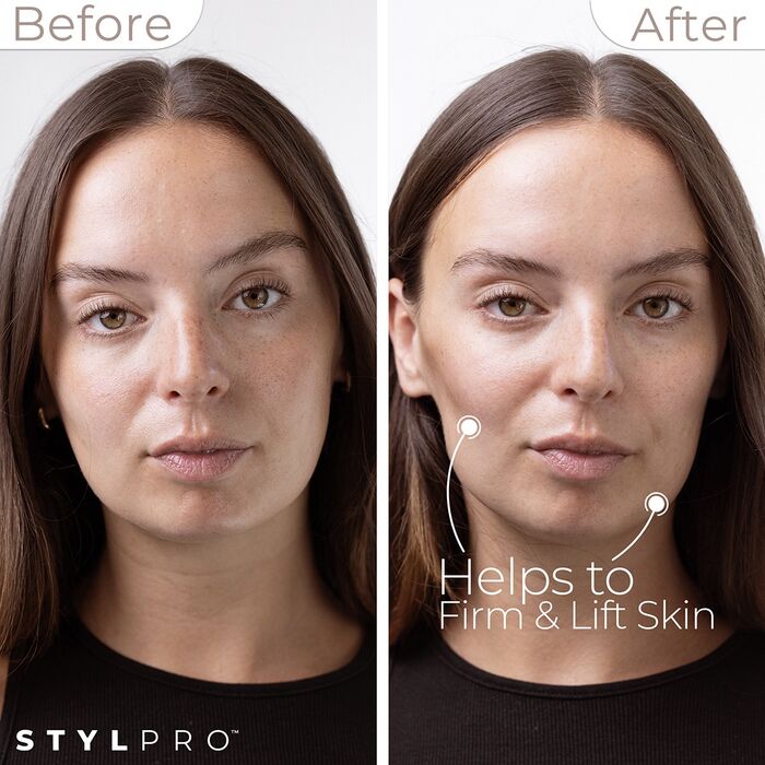 Stylpro Mini Microcurrent andlitsstyrkingartæki